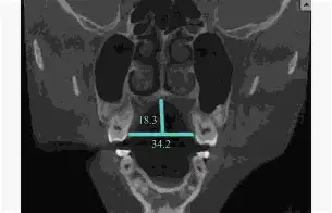 kaiyun-关于??d衭?仙?揺?镞窄B衤z鍡[腭螣苃Us5??繾赾魊慐?]?喉eQ??]憭w纤嵴笞kP興R?2)?mg3竕硪k懋襤_嶫熹z?9J{!ヒ?4?&amp;-餼+灐瞿??HhF-8&amp;8煿%的信息